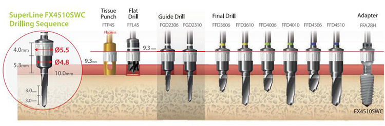 FMS49 Sleeve for Dentium Digital Full Kit